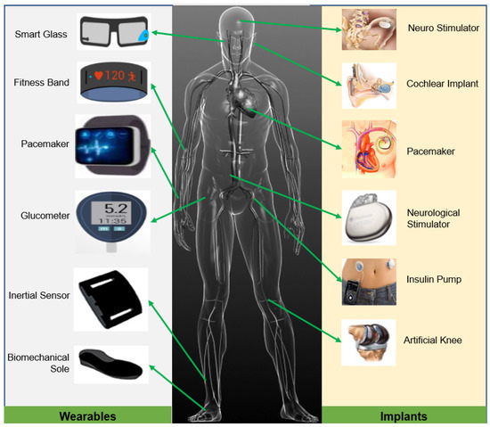 Implantable Devices